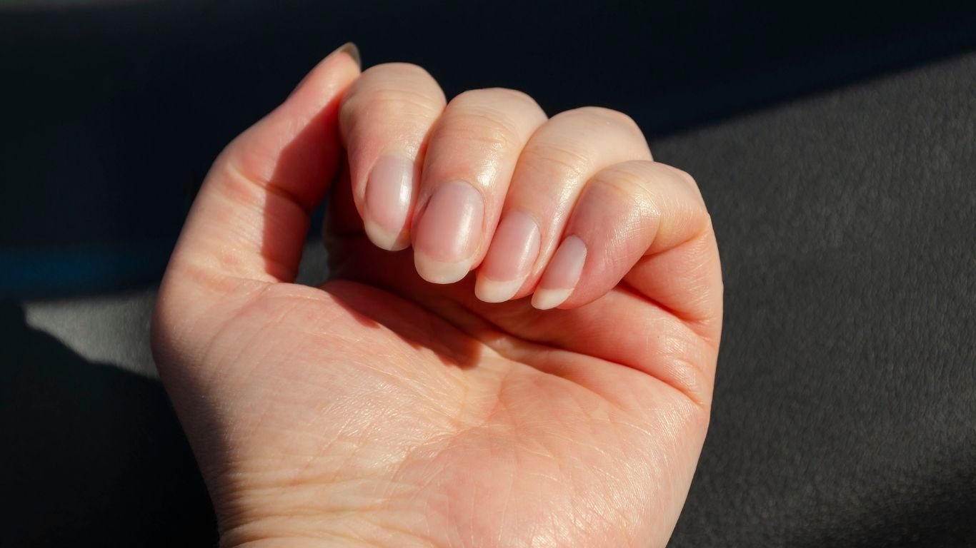 7 sinais nas unhas que revelam como está sua saúde e que você não deve ignorar