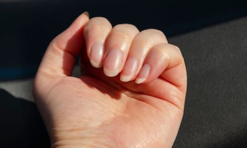 7 sinais nas unhas que revelam como está sua saúde e que você não deve ignorar